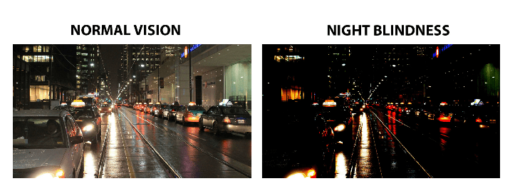 Night Blindness2